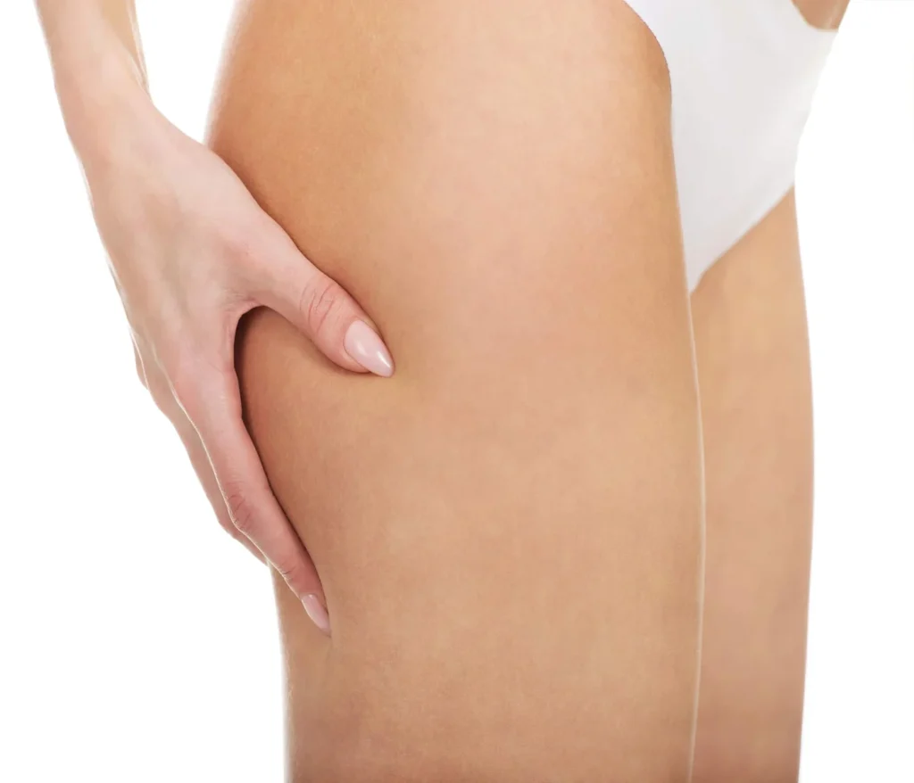 mesoterapia sevilla