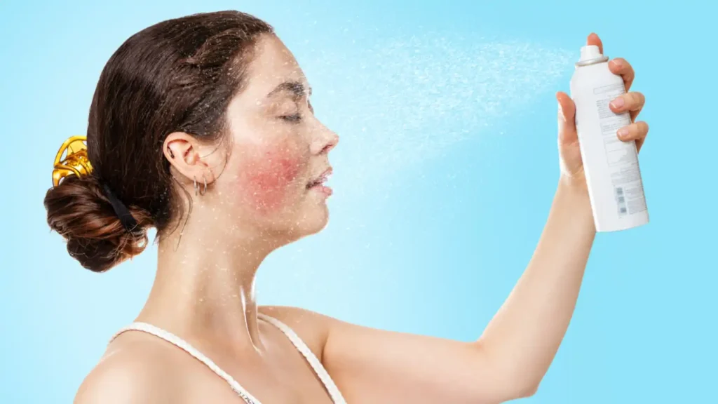 tratamiento para la rosacea sevilla