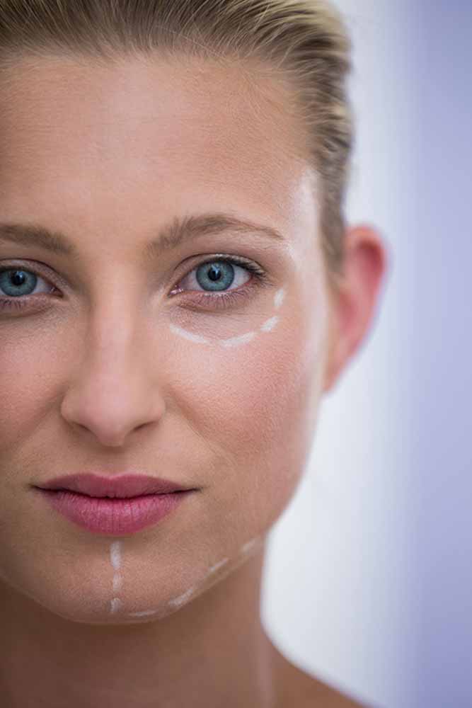tratamiento anti ojeras sevilla