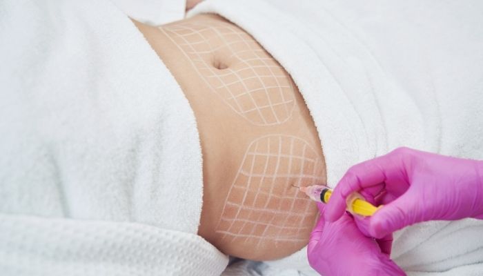 eliminar flacidez abdomen sin cirugía