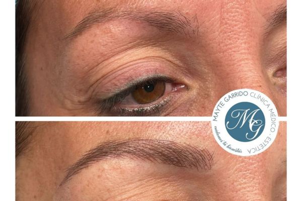 resultados microblading