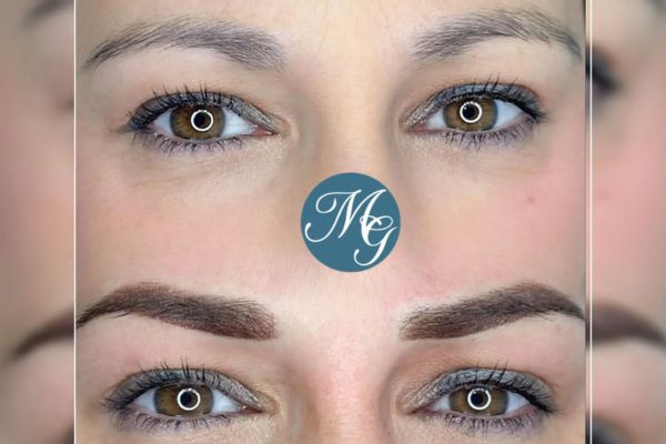 resultados microshading