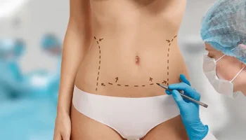 abdominoplastia precio